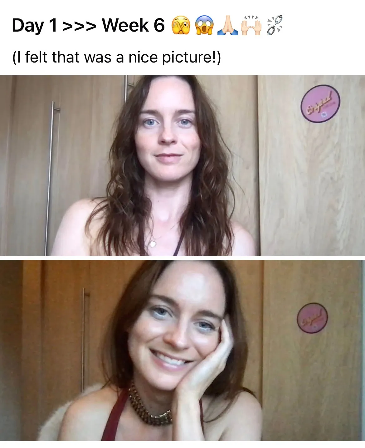 Before and after: Day 1 and Week 6